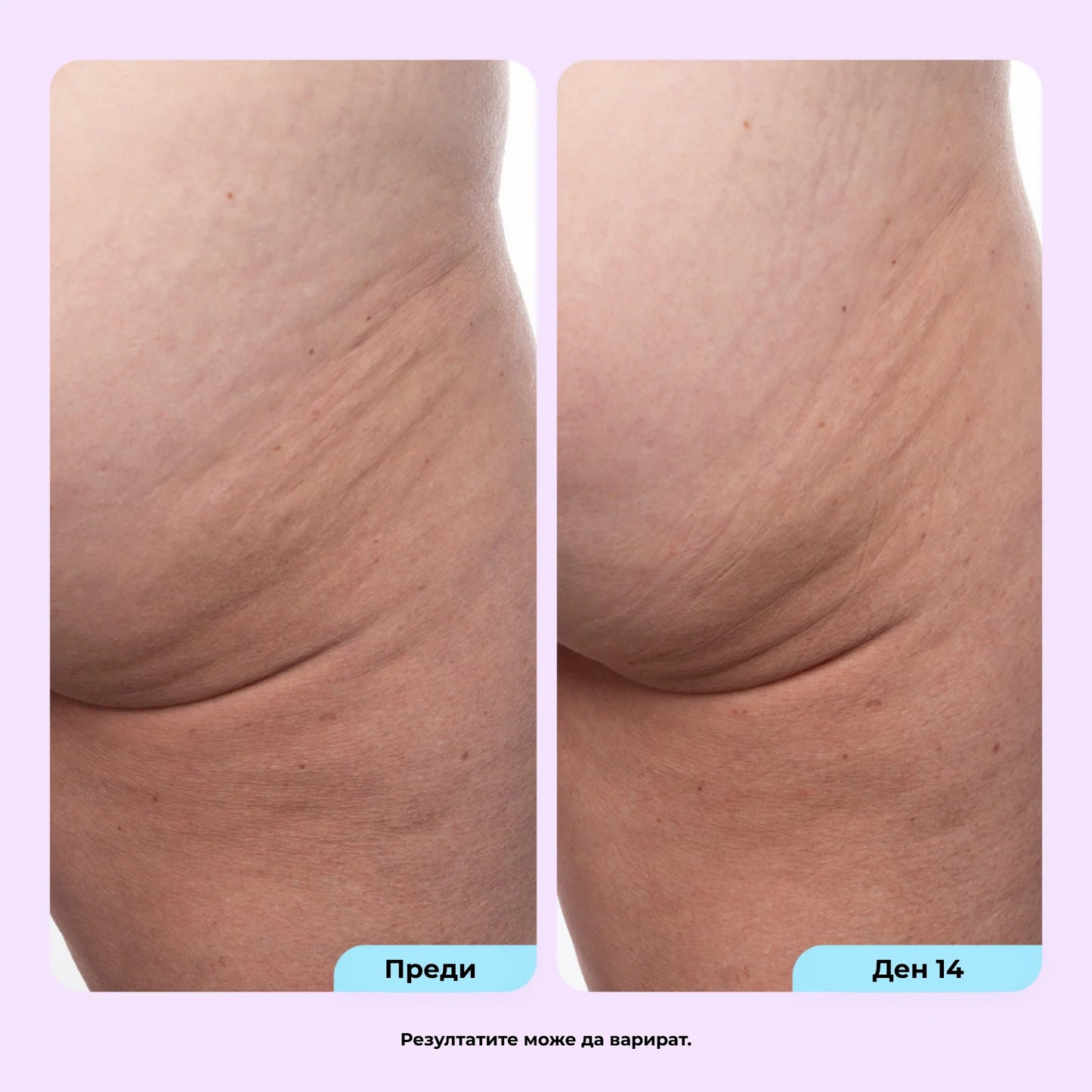 AT Labs™ Стягащ Крем