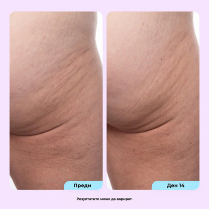 AT Labs™ Стягащ Крем